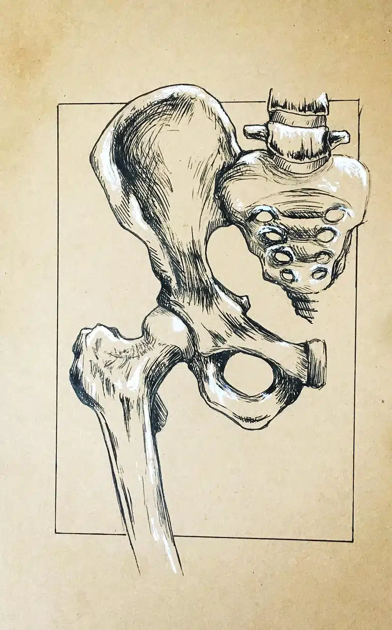 Fracture du fémur : quels sont les risques?